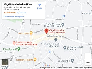 Tanden bleken hilversum
