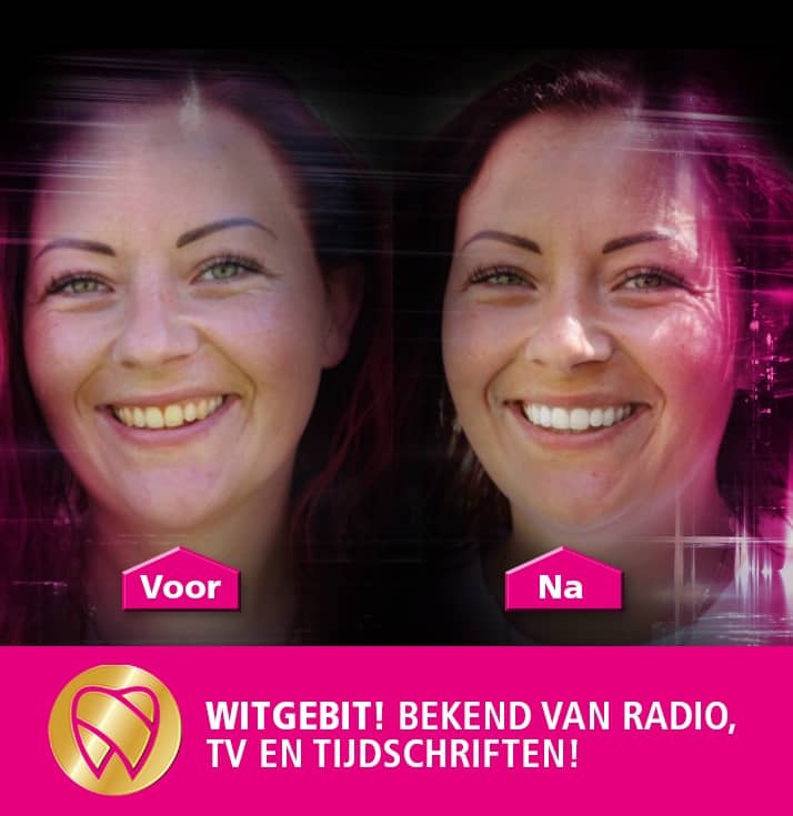 mobiel model